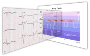 hrv and staging